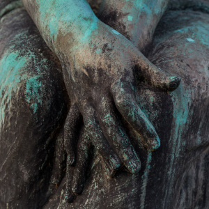 Close-up of weathered hands resting on a thigh, textured and raw.